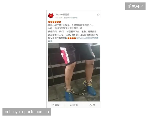 阿卡脚踝轻伤引全球关注